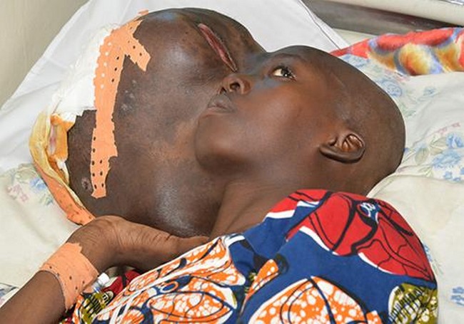 Tchad: Mispar Angeline opérée à l’hôpital Mère-Enfant de N’Djaména