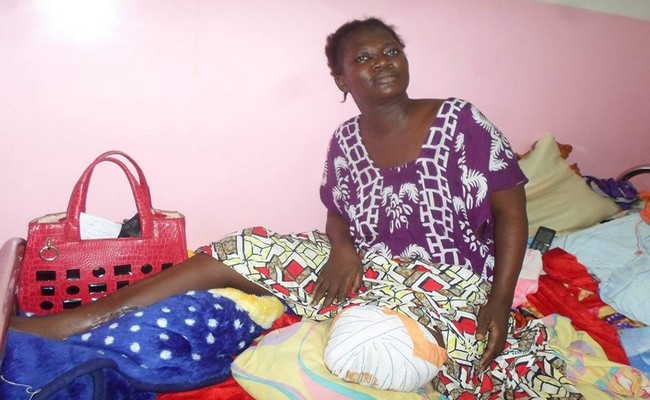 Amputée d’une jambe après les attentats terroristes de 2015 au Tchad, une infirmière lance un appel aux dons pour financer une prothèse