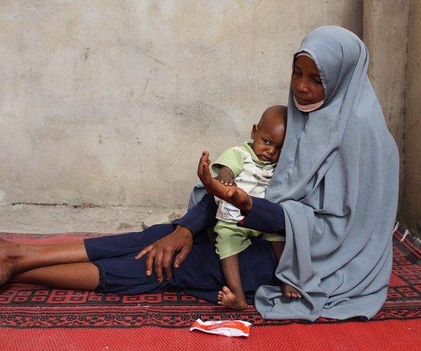 Tchad: Médecins Sans Frontières tire la sonnette d’alarme sur la malnutrition infantile dans la province du Hadjer Lamis