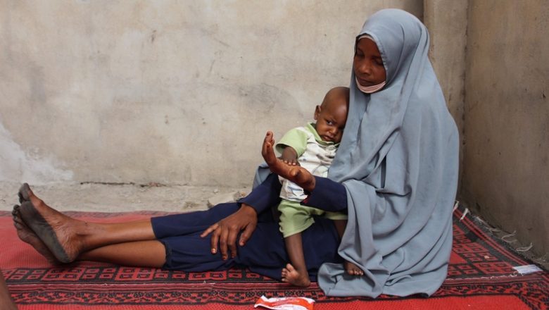 Tchad: Médecins Sans Frontières tire la sonnette d’alarme sur la malnutrition infantile dans la province du Hadjer Lamis